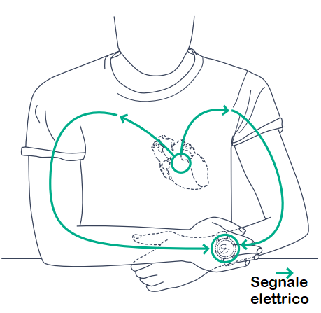 Smartwatch con ECG